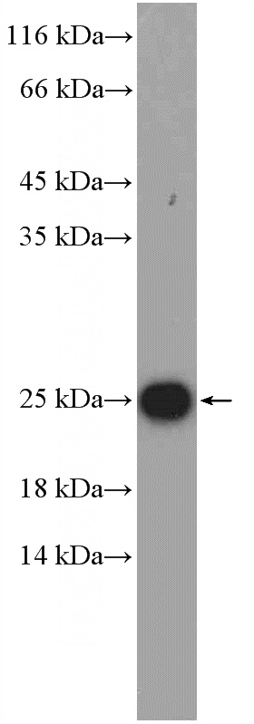 rat brain tissue were subjected to SDS PAGE followed by western blot with Catalog No:116724(VBP1 Antibody) at dilution of 1:1000