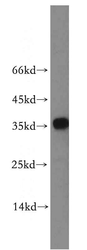 COLO 320 cells were subjected to SDS PAGE followed by western blot with Catalog No:113956(PLEKHA3 antibody) at dilution of 1:200