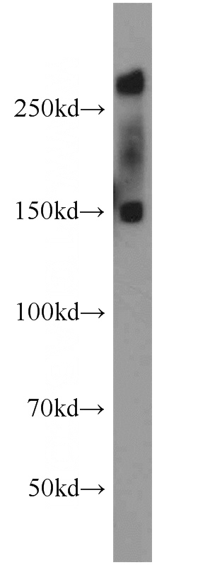 HeLa cells were subjected to SDS PAGE followed by western blot with Catalog No:113741(PCM1 antibody) at dilution of 1:500
