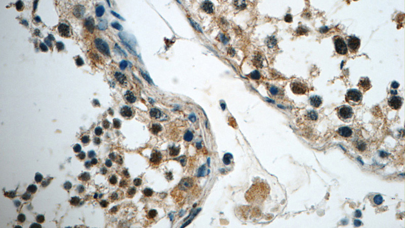 Immunohistochemistry of paraffin-embedded human testis tissue slide using Catalog No:111022(GLI3-Specific Antibody) at dilution of 1:50