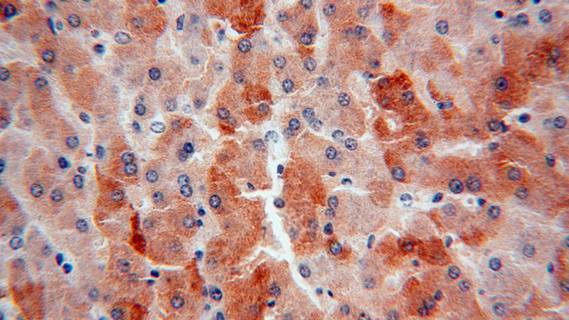 Immunohistochemical of paraffin-embedded human liver using Catalog No:114219(PROS1 antibody) at dilution of 1:100 (under 40x lens)