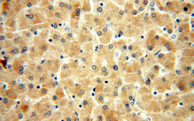 Immunohistochemical of paraffin-embedded human liver using Catalog No:113877(PI4K2B antibody) at dilution of 1:100 (under 40x lens)
