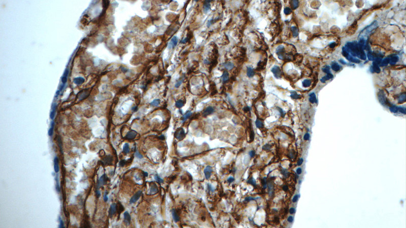 Immunohistochemistry of paraffin-embedded human placenta tissue slide using Catalog No:108003(AMPD3 Antibody) at dilution of 1:50 (under 40x lens)