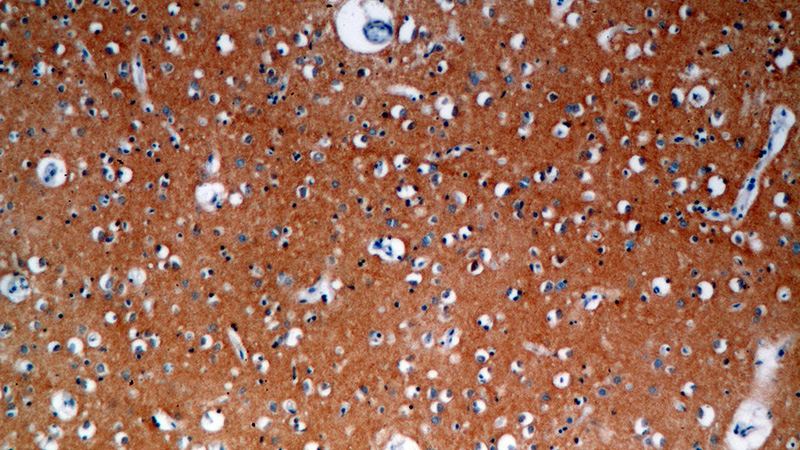 Immunohistochemical of paraffin-embedded human brain using Catalog No:109511(CPLX2 antibody) at dilution of 1:100 (under 10x lens)