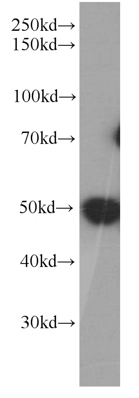 HEK-293 cells were subjected to SDS PAGE followed by western blot with Catalog No:107238(DEK Antibody) at dilution of 1:1000