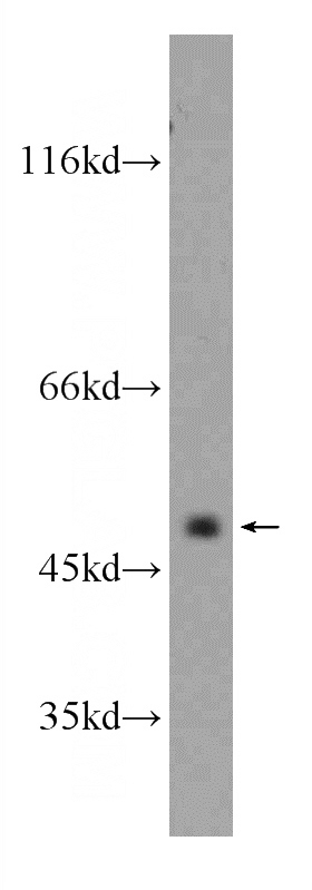 Raji cells were subjected to SDS PAGE followed by western blot with Catalog No:109645(CXCR7 antibody) at dilution of 1:500