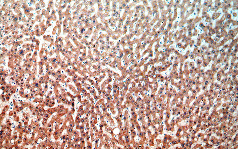Immunohistochemical of paraffin-embedded human liver using Catalog No:107966(ALDH2 antibody) at dilution of 1:100 (under 10x lens)