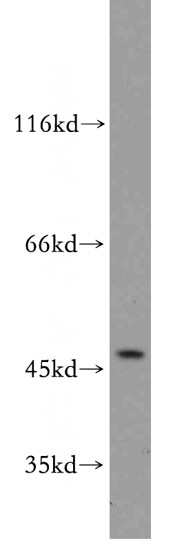 MCF7 cells were subjected to SDS PAGE followed by western blot with Catalog No:117128(SGCB antibody) at dilution of 1:300