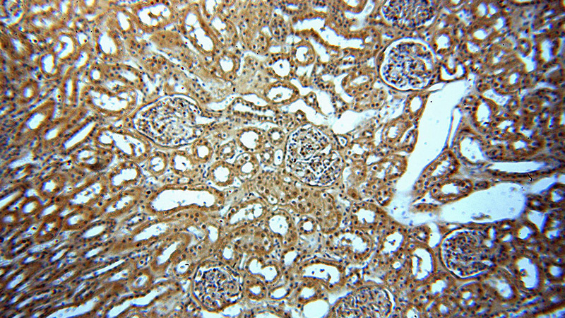 Immunohistochemical of paraffin-embedded human kidney using Catalog No:113909(PNN antibody) at dilution of 1:50 (under 10x lens)