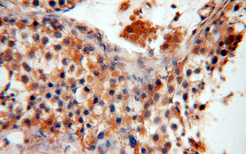 Immunohistochemical of paraffin-embedded human testis using Catalog No:116655(UBN2 antibody) at dilution of 1:50 (under 40x lens)