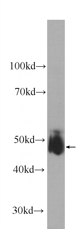 human blood tissue were subjected to SDS PAGE followed by western blot with Catalog No:107360(KCNN4 Antibody) at dilution of 1:1000