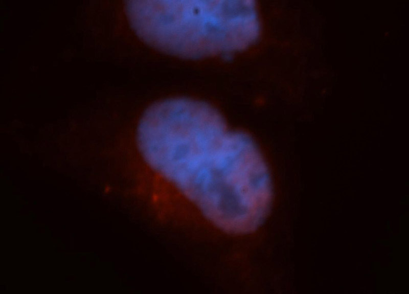 Immunofluorescent analysis of HepG2 cells, using CARD8 antibody Catalog No:108857 at 1:50 dilution and Rhodamine-labeled goat anti-rabbit IgG (red). Blue pseudocolor = DAPI (fluorescent DNA dye).