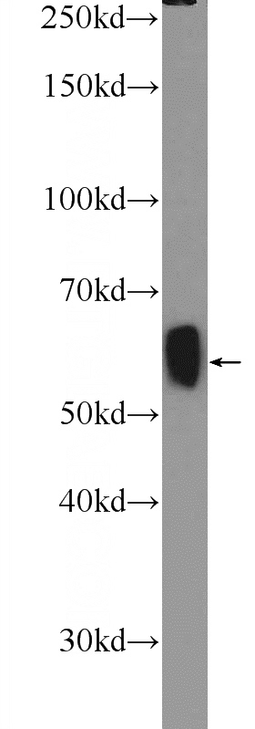 mouse brain tissue were subjected to SDS PAGE followed by western blot with Catalog No:110817(GAD2 Antibody) at dilution of 1:600