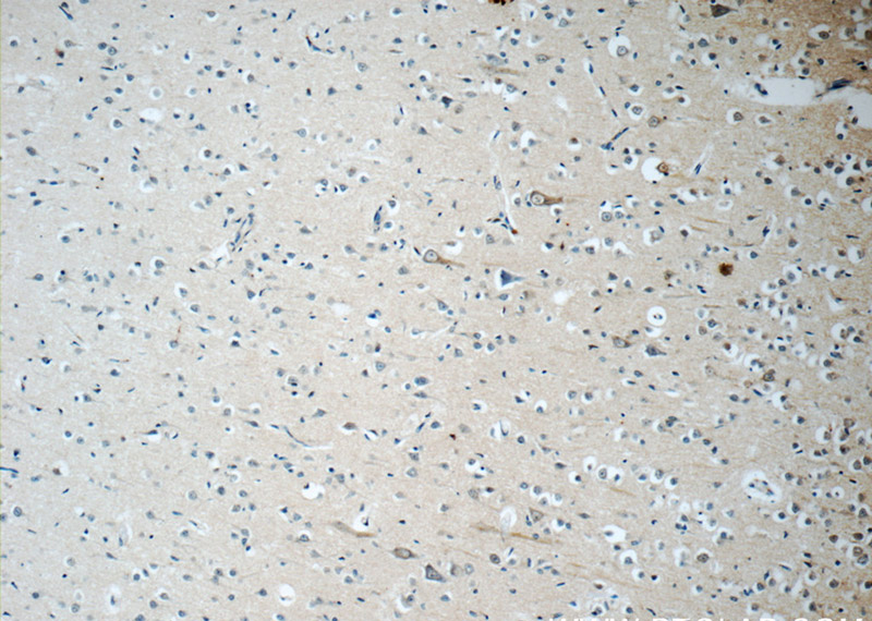 Immunohistochemistry of paraffin-embedded human brain tissue slide using Catalog No:107359(KCNMB4 Antibody) at dilution of 1:50 (under 10x lens)