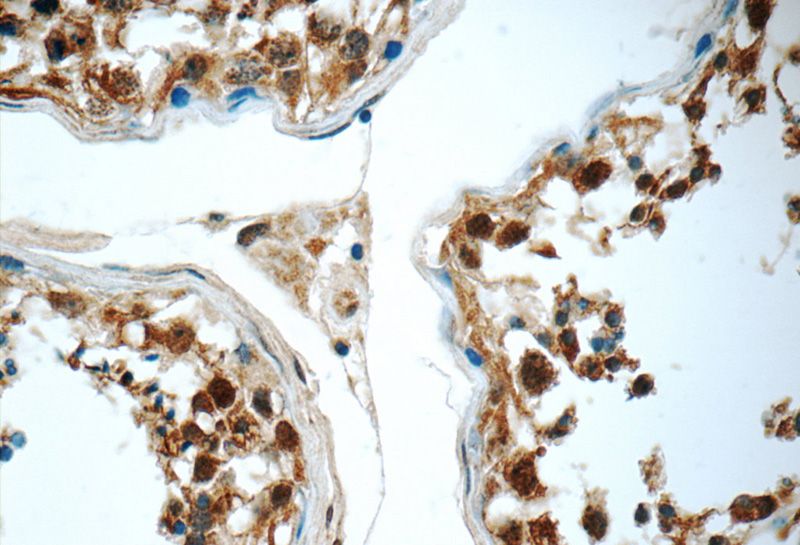 Immunohistochemistry of paraffin-embedded human testis tissue slide using Catalog No:111898(JTV1 Antibody) at dilution of 1:50 (under 40x lens)