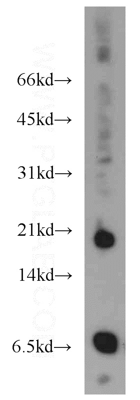 mouse heart tissue were subjected to SDS PAGE followed by western blot with Catalog No:110339(Eotaxin antibody) at dilution of 1:1000
