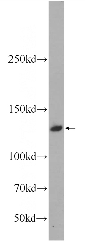 L02 cells were subjected to SDS PAGE followed by western blot with Catalog No:108854(CARD11 Antibody) at dilution of 1:500