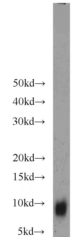 mouse testis tissue were subjected to SDS PAGE followed by western blot with Catalog No:116156(TNP1 antibody) at dilution of 1:1000