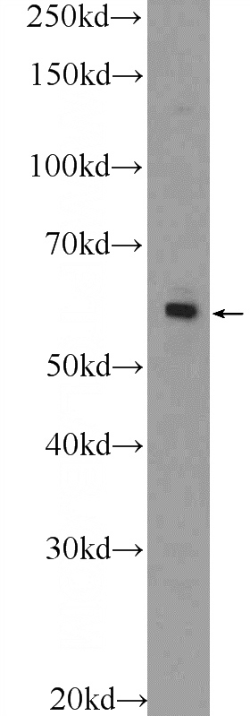 A549 cells were subjected to SDS PAGE followed by western blot with Catalog No:117175(ZNF419 Antibody) at dilution of 1:600