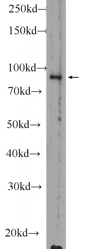 mouse testis tissue were subjected to SDS PAGE followed by western blot with Catalog No:114541(RANBP9 Antibody) at dilution of 1:600