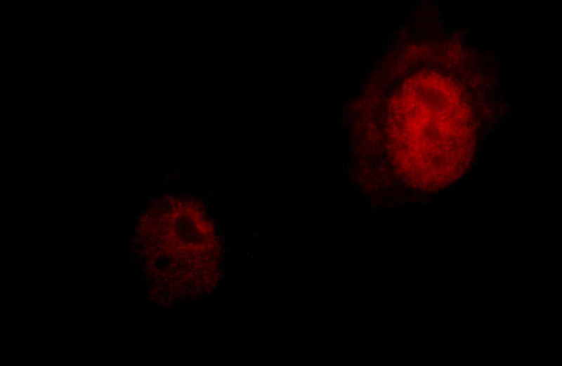Immunofluorescent analysis of HepG2 cells, using NFYA antibody Catalog No:113167 at 1:25 dilution and Rhodamine-labeled goat anti-rabbit IgG (red).
