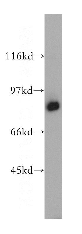 mouse spleen tissue were subjected to SDS PAGE followed by western blot with Catalog No:112908(MX1 antibody) at dilution of 1:300