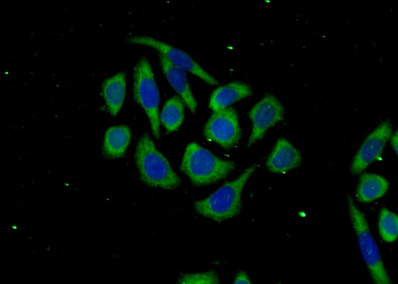 Immunofluorescent analysis of (-20oc Ethanol) fixed PC-3 cells using Catalog No:116380(TTC31 Antibody) at dilution of 1:50 and Alexa Fluor 488-congugated AffiniPure Goat Anti-Rabbit IgG(H+L)