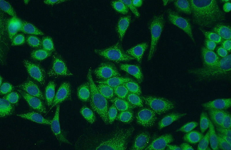 Immunofluorescent analysis of HeLa cells using Catalog No:113901(PIK3C2A Antibody) at dilution of 1:50 and Alexa Fluor 488-congugated AffiniPure Goat Anti-Rabbit IgG(H+L)