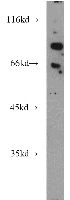 Jurkat cells were subjected to SDS PAGE followed by western blot with Catalog No:110708(FOXP1 antibody) at dilution of 1:1000