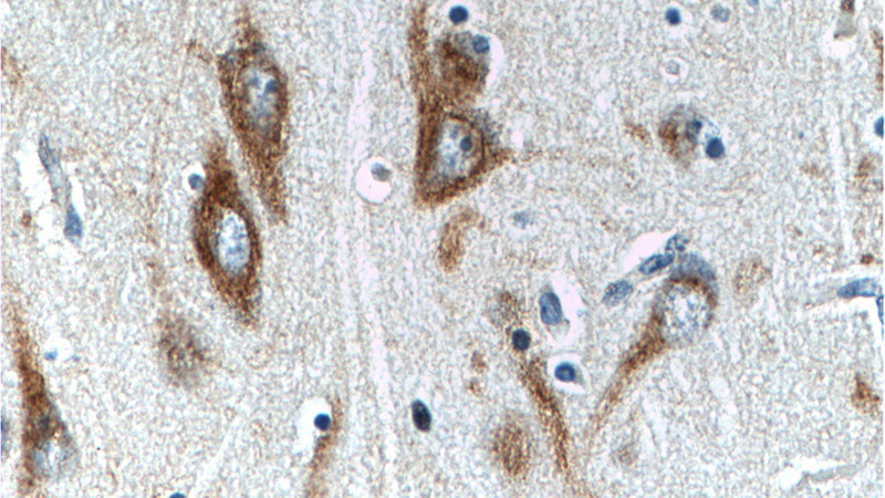 Immunohistochemistry of paraffin-embedded human brain tissue slide using Catalog No:114943(RXFP1 Antibody) at dilution of 1:100 (under 40x lens).