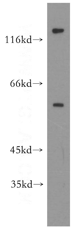 mouse ovary tissue were subjected to SDS PAGE followed by western blot with Catalog No:111172(GSK3B antibody) at dilution of 1:300
