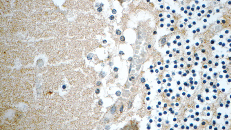 Immunohistochemistry of paraffin-embedded human cerebellum tissue slide using Catalog No:109285(CHRNB3 Antibody) at dilution of 1:50 (under 40x lens)