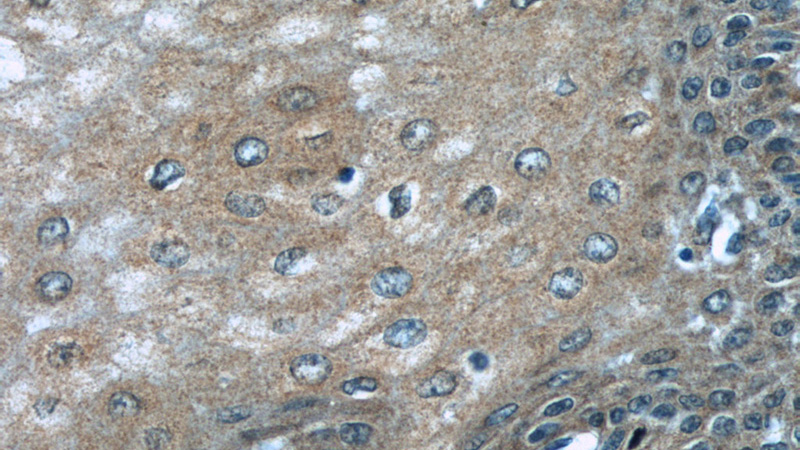 Immunohistochemical of paraffin-embedded human oesophagus using Catalog No:114010(PLS3 antibody) at dilution of 1:50 (under 40x lens)