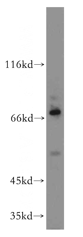 Raji cells were subjected to SDS PAGE followed by western blot with Catalog No:113937(PLAGL2 antibody) at dilution of 1:300