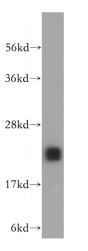 human liver tissue were subjected to SDS PAGE followed by western blot with Catalog No:112779(MTHFS antibody) at dilution of 1:500