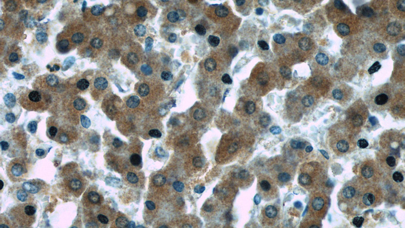 Immunohistochemistry of paraffin-embedded human liver slide using Catalog No:116815(WDR7 Antibody) at dilution of 1:50