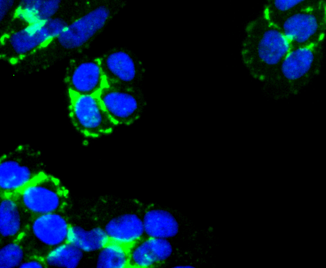 Fig2:; ICC staining of Laminnin 5 alpha 3 in Hela cells (green). Formalin fixed cells were permeabilized with 0.1% Triton X-100 in TBS for 10 minutes at room temperature and blocked with 1% Blocker BSA for 15 minutes at room temperature. Cells were probed with the primary antibody ( 1/50) for 1 hour at room temperature, washed with PBS. Alexa Fluor®488 Goat anti-Rabbit IgG was used as the secondary antibody at 1/1,000 dilution. The nuclear counter stain is DAPI (blue).