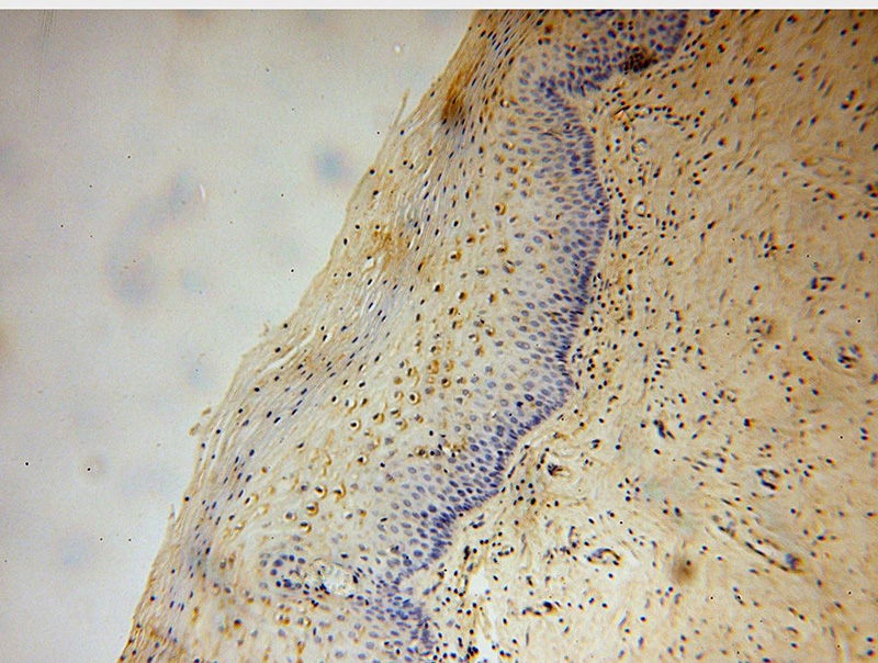 Immunohistochemical of paraffin-embedded human cervix using Catalog No:109914(DGKQ antibody) at dilution of 1:50 (under 10x lens)