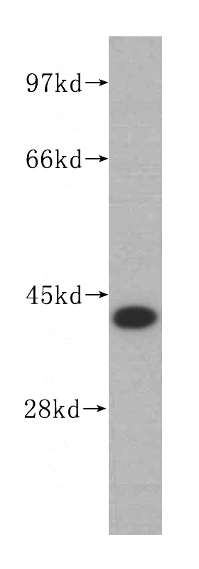 MCF7 cells were subjected to SDS PAGE followed by western blot with Catalog No:109919(DHODH antibody) at dilution of 1:500