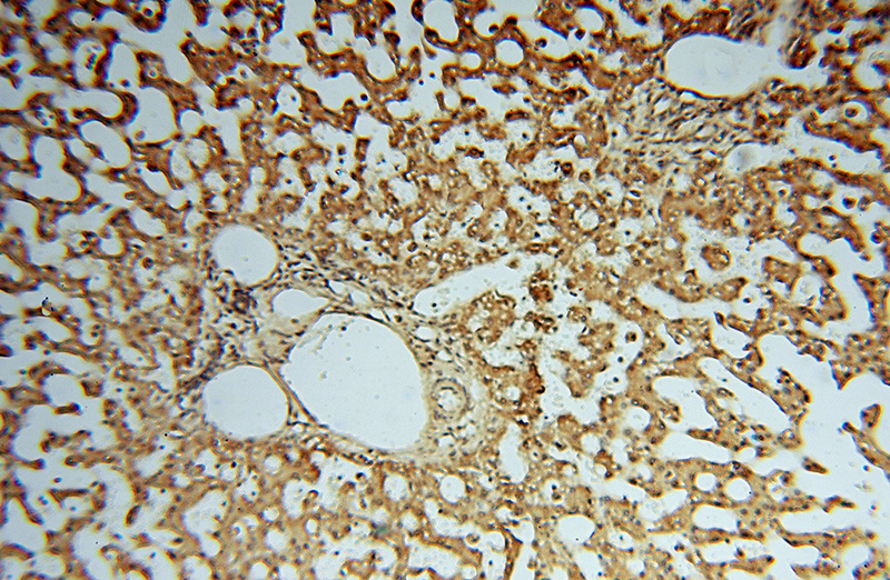 Immunohistochemical of paraffin-embedded human liver using Catalog No:114383(PSMB3 antibody) at dilution of 1:50 (under 10x lens)
