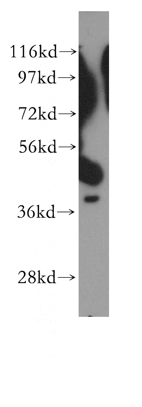 NIH/3T3 cells were subjected to SDS PAGE followed by western blot with Catalog No:110196(EIF3H antibody) at dilution of 1:500