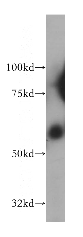 human colon tissue were subjected to SDS PAGE followed by western blot with Catalog No:115640(SPPL2A antibody) at dilution of 1:500