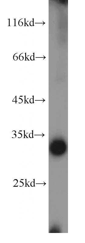 human liver tissue were subjected to SDS PAGE followed by western blot with Catalog No:112816(MRPL2 antibody) at dilution of 1:500