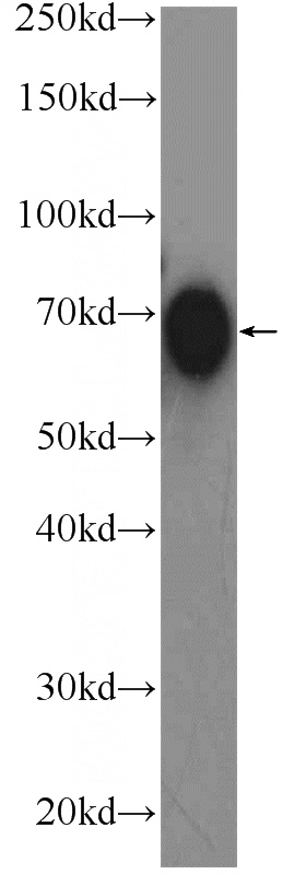 human saliva tissue were subjected to SDS PAGE followed by western blot with Catalog No:115912(TCN1 Antibody) at dilution of 1:2000