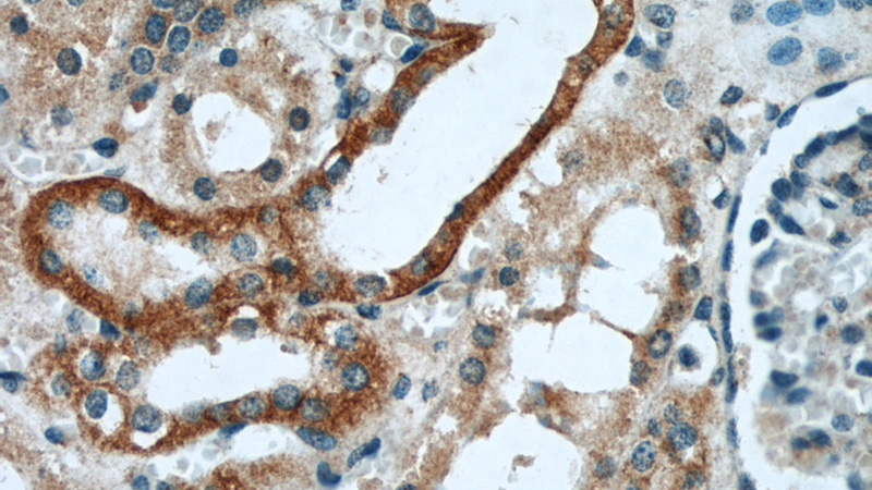 Immunohistochemical of paraffin-embedded human kidney using Catalog No:113526(OXER1 antibody) at dilution of 1:50 (under 40x lens)