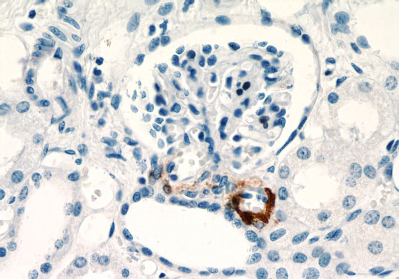 Immunohistochemistry of paraffin-embedded human kidney slide using Catalog No:114689(REN Antibody) at dilution of 1:200