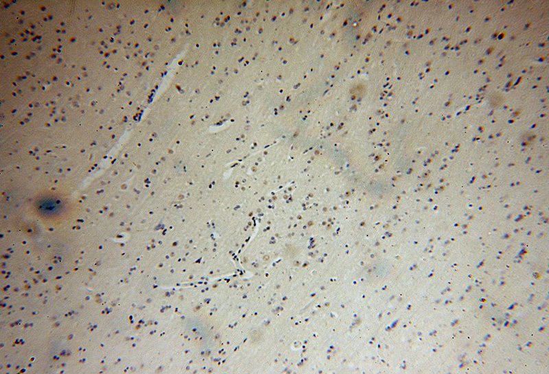 Immunohistochemical of paraffin-embedded human brain using Catalog No:110516(FANCC antibody) at dilution of 1:100 (under 10x lens)