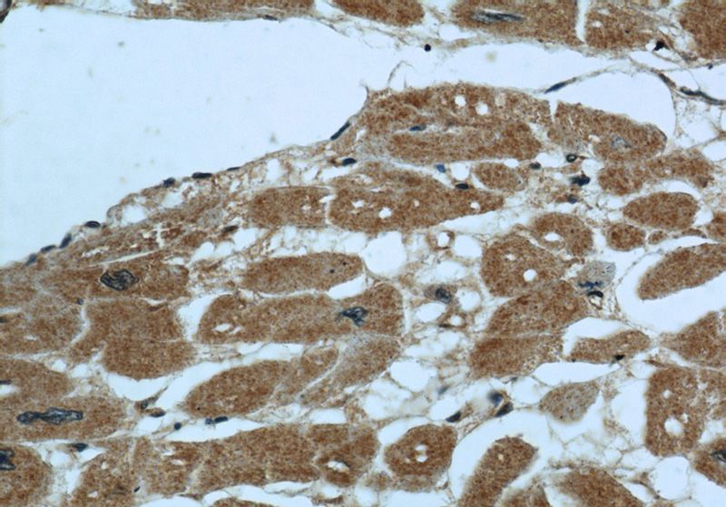 Immunohistochemical of paraffin-embedded human heart using Catalog No:113901(PIK3C2A antibody) at dilution of 1:50 (under 40x lens)