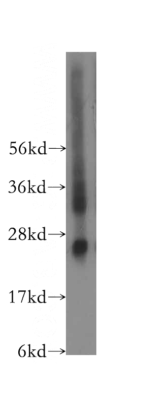 human placenta tissue were subjected to SDS PAGE followed by western blot with Catalog No:113933(CSH2 antibody) at dilution of 1:500