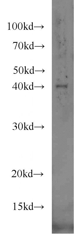 MCF7 cells were subjected to SDS PAGE followed by western blot with Catalog No:111962(IVD antibody) at dilution of 1:300